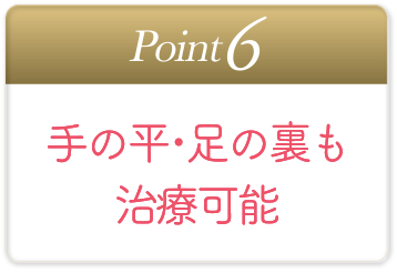 手の平・足の裏も治療可能